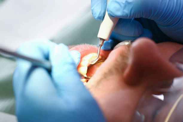 Best Pediatric Emergency Dentist in Algonac, MI