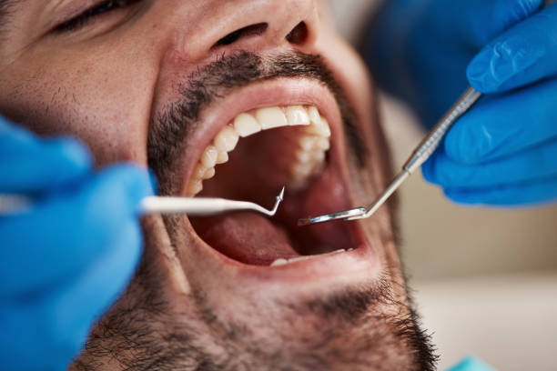 Best Urgent Dental Care for Toothache in Algonac, MI